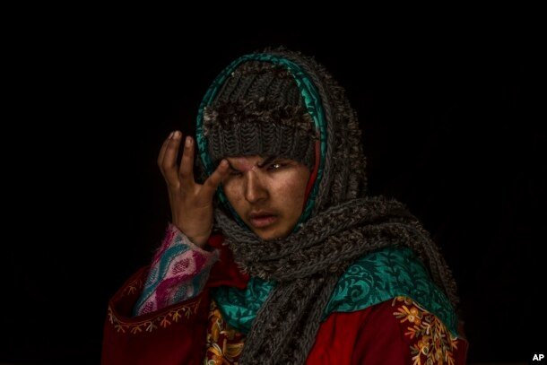 Insha Mushtaq Malik poses for a portrait inside her home in Sedow, south Kashmir, Nov. 29, 2016. Insha says she was standing by the window of her village home watching protesters and troops skirmish when more than a 100 pellets hit her face.