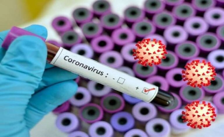 Covid-19 Virus Test Results May Vary Based on Time of Day: Study