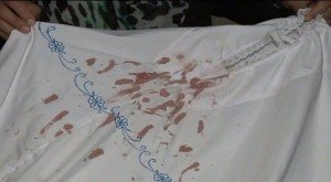  The blood-stained scarf of the Muslim woman who was attacked. 